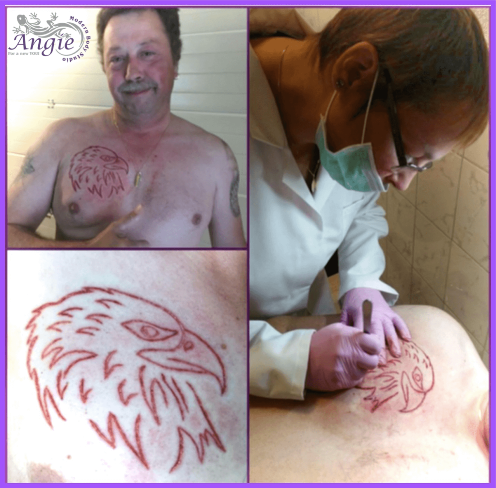 Scarring Body Modification Scarification – Modern Body Studio