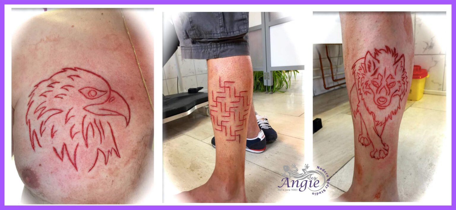 Scarification – Modern Body Studio